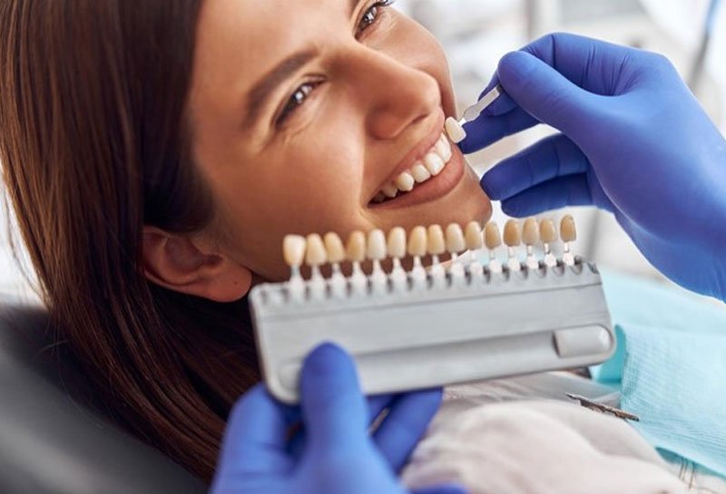 Dental veneers in Gurgaon at Muskaan Dentals