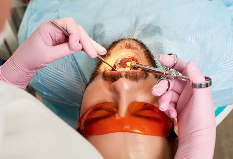 Flap surgery for gum disease in Gurgaon at Muskaan Dentals